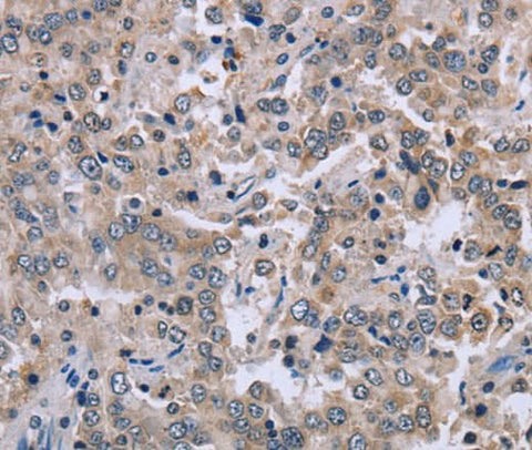 Anti-Human EID1 Antibody - ABMIUM