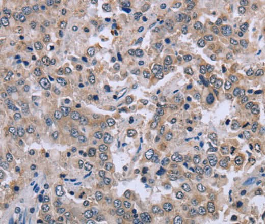 Anti-Human EID1 Antibody - ABMIUM