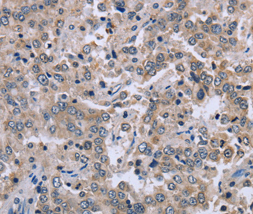 Anti-Human EID1 Antibody - ABMIUM