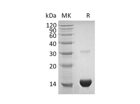 Recombinant Human Thioredoxin/TXN Protein (His Tag) - ABMIUM