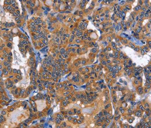 Anti-Human/Mouse/Rat MUSK Antibody