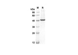 SDS-PAGE analysis of Human CHI3L1 proteins, 2 μg/lane of Recombinant Human CHI3L1 proteins was resolved with an SDS-PAGE under reducing conditions, showing bands at 42 kDa.
