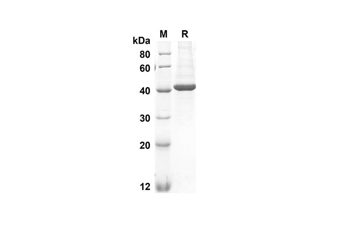 SDS-PAGE analysis of Human CHI3L1 proteins, 2 μg/lane of Recombinant Human CHI3L1 proteins was resolved with an SDS-PAGE under reducing conditions, showing bands at 42 kDa.