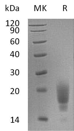 Recombinant Mouse TIGIT Protein (His Tag) - ABMIUM