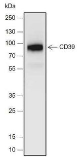 Anti-Human/Mouse CD39 Antibody [A701]