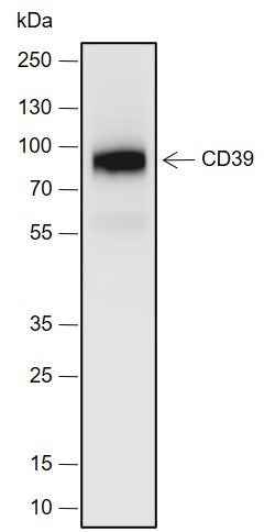 Anti-Human/Mouse CD39 Antibody [A701]