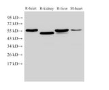 Western Blot analysis of Rat heart, Rat kidney, Rat liver and Mouse heart using FGB Polyclonal Antibody at dilution of 1:4000