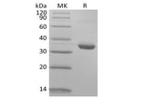 Recombinant Human IgG1 Fc Biotinylated - ABMIUM