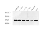 Western Blot analysis of various samples using Survivin Polyclonal Antibody at dilution of 1:600.