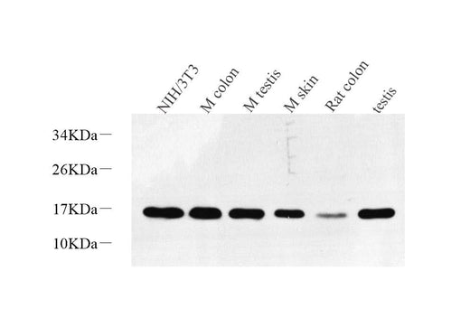Western Blot analysis of various samples using Survivin Polyclonal Antibody at dilution of 1:600.