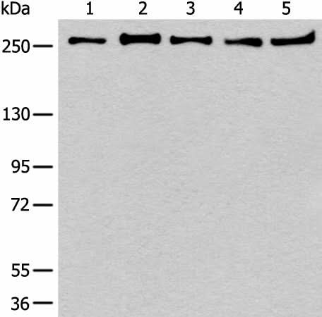 Western blot analysis of 293T K562 Raji Hela and NIH/3T3 cell lysates using PRPF8 Polyclonal Antibody at dilution of 1:600