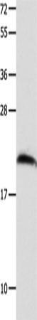 Anti-Human/Mouse/Rat FGF12 Antibody - ABMIUM