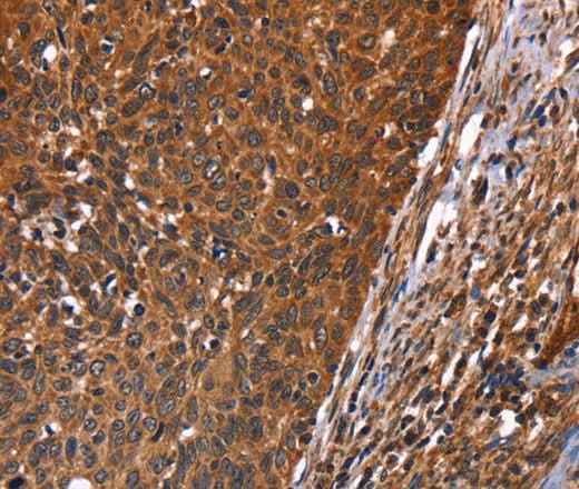 Anti-Human/Mouse GUK1 Antibody