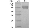 Recombinant Human CSF2RA/GM-CSFR Protein (His Tag) - ABMIUM