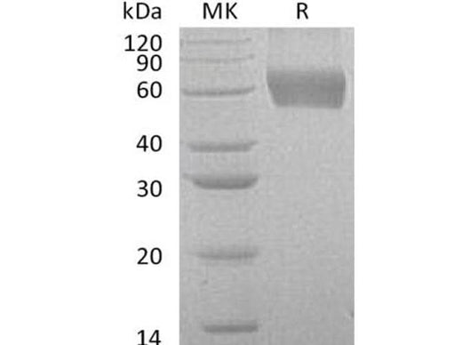 Recombinant Human CSF2RA/GM-CSFR Protein (His Tag) - ABMIUM