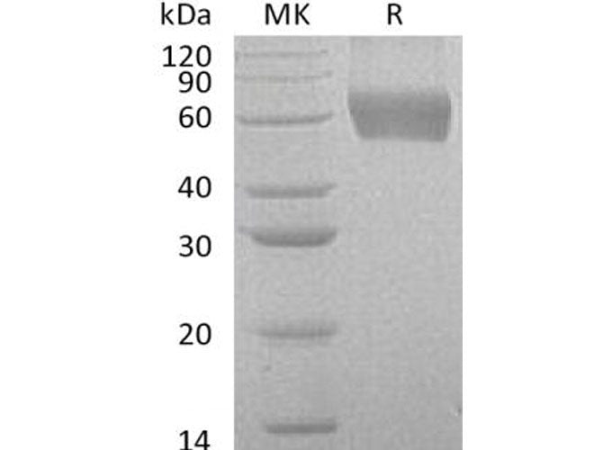 Recombinant Human CSF2RA/GM-CSFR Protein (His Tag) - ABMIUM