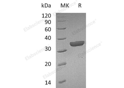 Recombinant Mouse Granzyme B(G,H)/GZMB Protein (His Tag) - ABMIUM