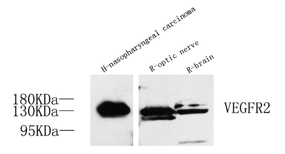 Western Blot analysis of various samples using FLK1 Polyclonal Antibody at dilution of 1:800.