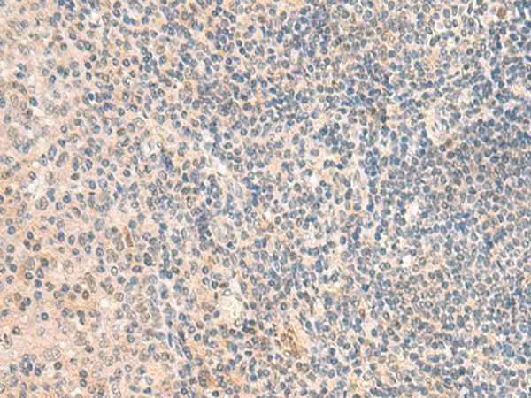 Anti-Human/Mouse/Rat GRM2 Antibody