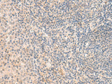 Immunohistochemistry of paraffin-embedded Human tonsil tissue using GRM2 Polyclonal Antibody at dilution of 1:50(×200)