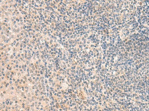 Immunohistochemistry of paraffin-embedded Human tonsil tissue using GRM2 Polyclonal Antibody at dilution of 1:50(×200)