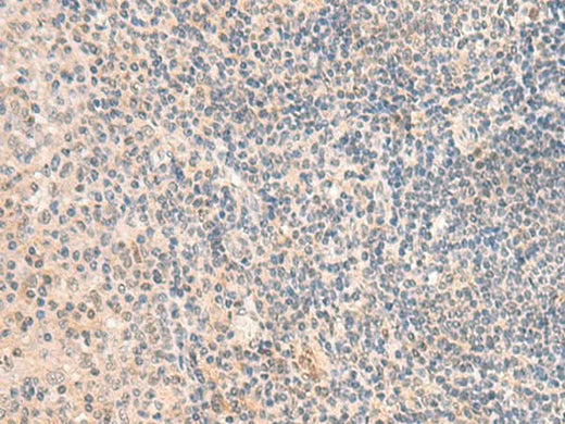 Immunohistochemistry of paraffin-embedded Human tonsil tissue using GRM2 Polyclonal Antibody at dilution of 1:50(×200)