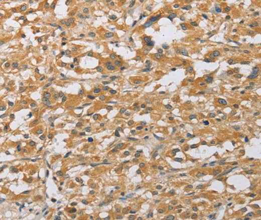 Anti-Human/Mouse/Rat ARHGEF1 Antibody