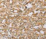 Anti-Human/Mouse/Rat ARHGEF1 Antibody - ABMIUM