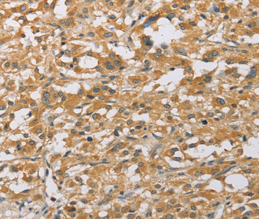 Anti-Human/Mouse/Rat ARHGEF1 Antibody - ABMIUM