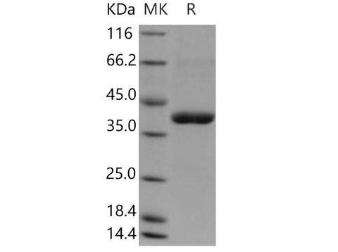 > 88 % as determined by reducing SDS-PAGE.
