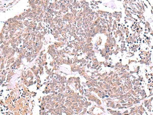 Anti-Human/Mouse/Rat JDP2 Antibody