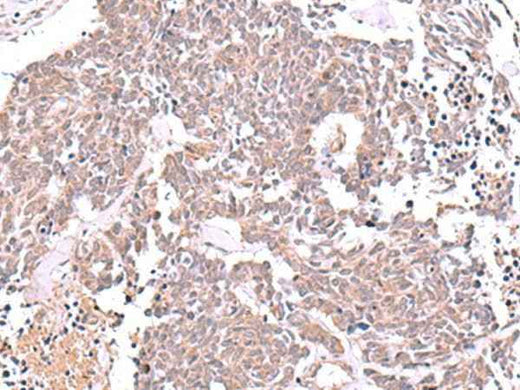 Anti-Human/Mouse/Rat JDP2 Antibody