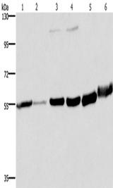 Anti-Human/Mouse/Rat MCHR1 Antibody - ABMIUM
