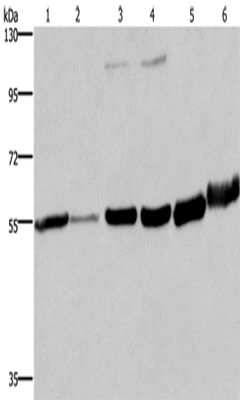 Anti-Human/Mouse/Rat MCHR1 Antibody - ABMIUM