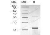Recombinant Human ZNF100 Protein (His Tag) - ABMIUM
