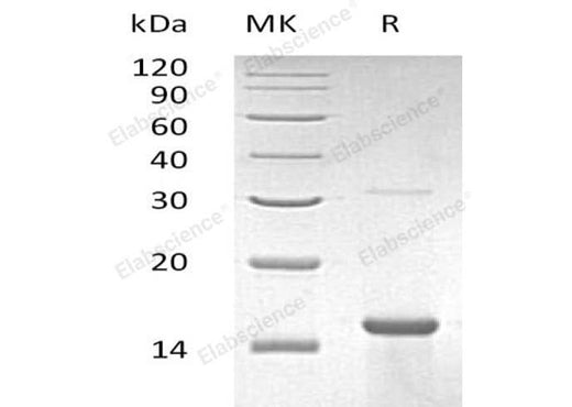 Recombinant Human ZNF100 Protein (His Tag) - ABMIUM