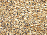 Anti-Human SLC6A19 Antibody - ABMIUM