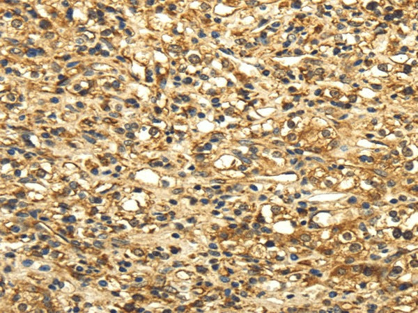 Anti-Human SLC6A19 Antibody - ABMIUM