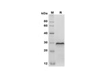 SDS-PAGE analysis of Mouse CD40/TNFRSF5 proteins, 2 μg/lane of Recombinant Mouse CD40/TNFRSF5 proteins was resolved with SDS-PAGE under reducing conditions, showing bands at 30 kDa.