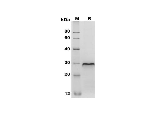 SDS-PAGE analysis of Mouse CD40/TNFRSF5 proteins, 2 μg/lane of Recombinant Mouse CD40/TNFRSF5 proteins was resolved with SDS-PAGE under reducing conditions, showing bands at 30 kDa.