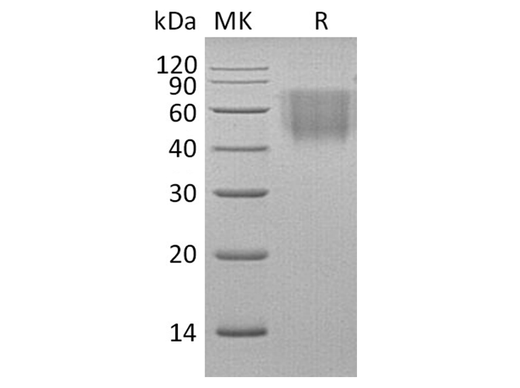 Recombinant Rhesus macaque B7-2/CD86 Protein (His Tag) - ABMIUM