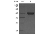 Recombinant Human RNASET2 Protein (Human Cells, His Tag) - ABMIUM
