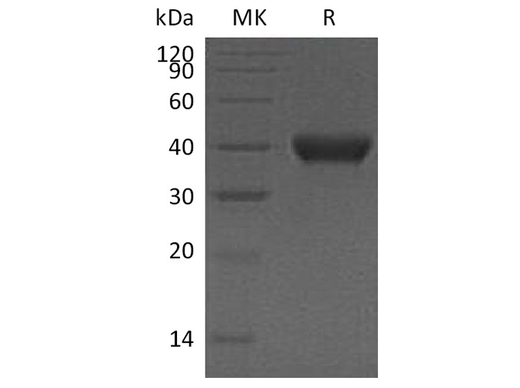 Recombinant Human RNASET2 Protein (Human Cells, His Tag) - ABMIUM