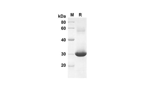 SDS-PAGE analysis of Rat CXCL3 proteins, 2 μg/lane of Recombinant Rat CXCL3 proteins was resolved with an SDS-PAGE under reducing conditions, showing bands at 27.6 kDa.