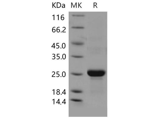 Recombinant Mouse CLEC3B/Tetranectin Protein (His Tag) - ABMIUM