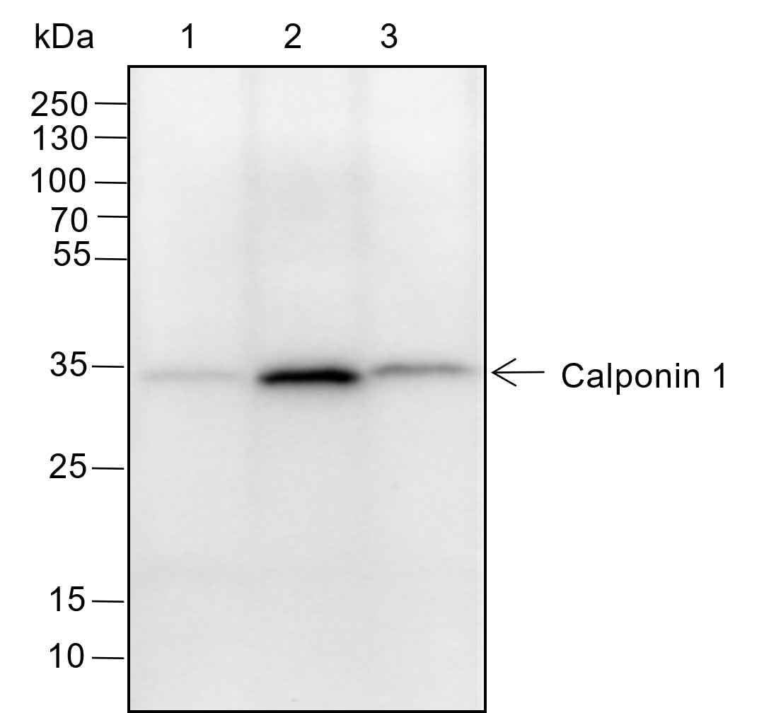 Anti-Human/Rat/Mouse Calponin 1 Antibody [A150] - ABMIUM