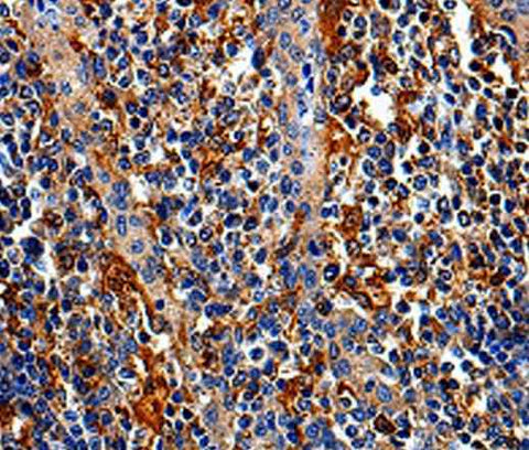 Anti-Human/Mouse COX16 Antibody