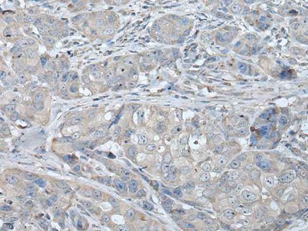 Anti-Human/Rat RASA1 Antibody