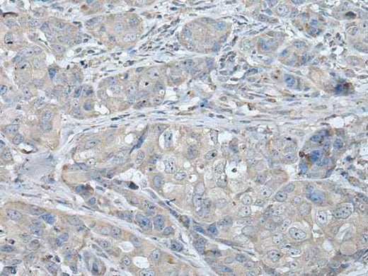 Anti-Human/Rat RASA1 Antibody