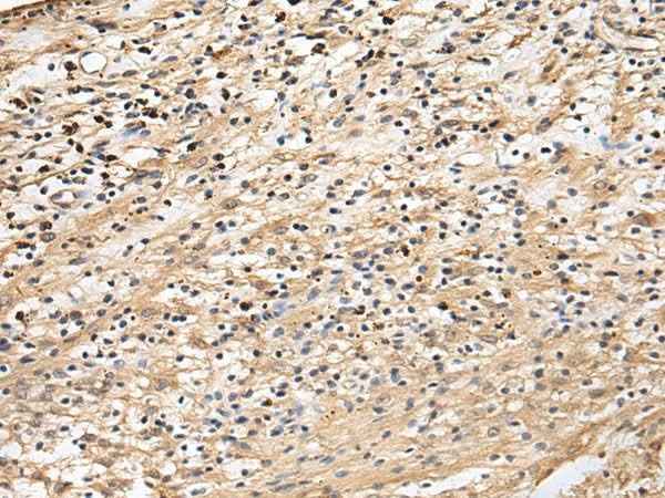 Anti-Human CRACR2A Antibody